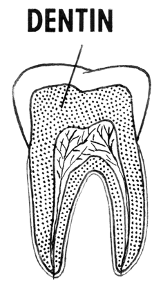 Auch das Dentin kann durch Nichtbehandlung angegriffen werden.