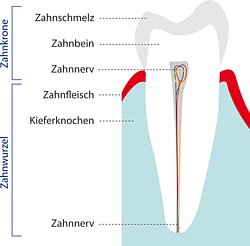 Zahnaufbau in schematischer Darstellung