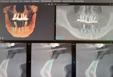 3D-Planung am Computer